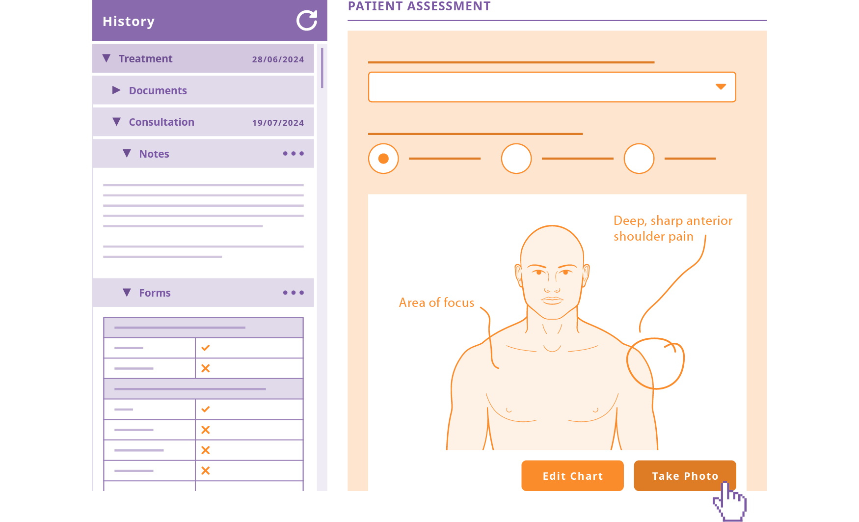 An example of the consultation or treatment notes facilities in PPS including a preview of a patient form that features a body chart